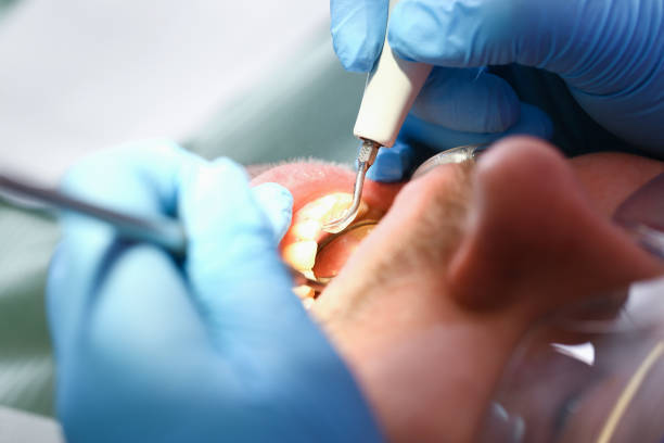 Best Emergency Gum Treatment in Chesterfield, IN