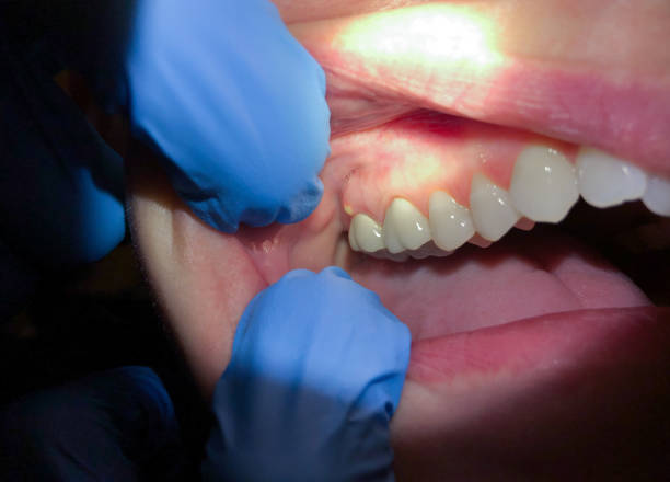 Best Weekend Emergency Dentist in Chesterfield, IN