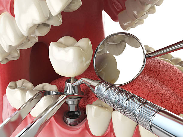 Best Pediatric Emergency Dentist in Chesterfield, IN